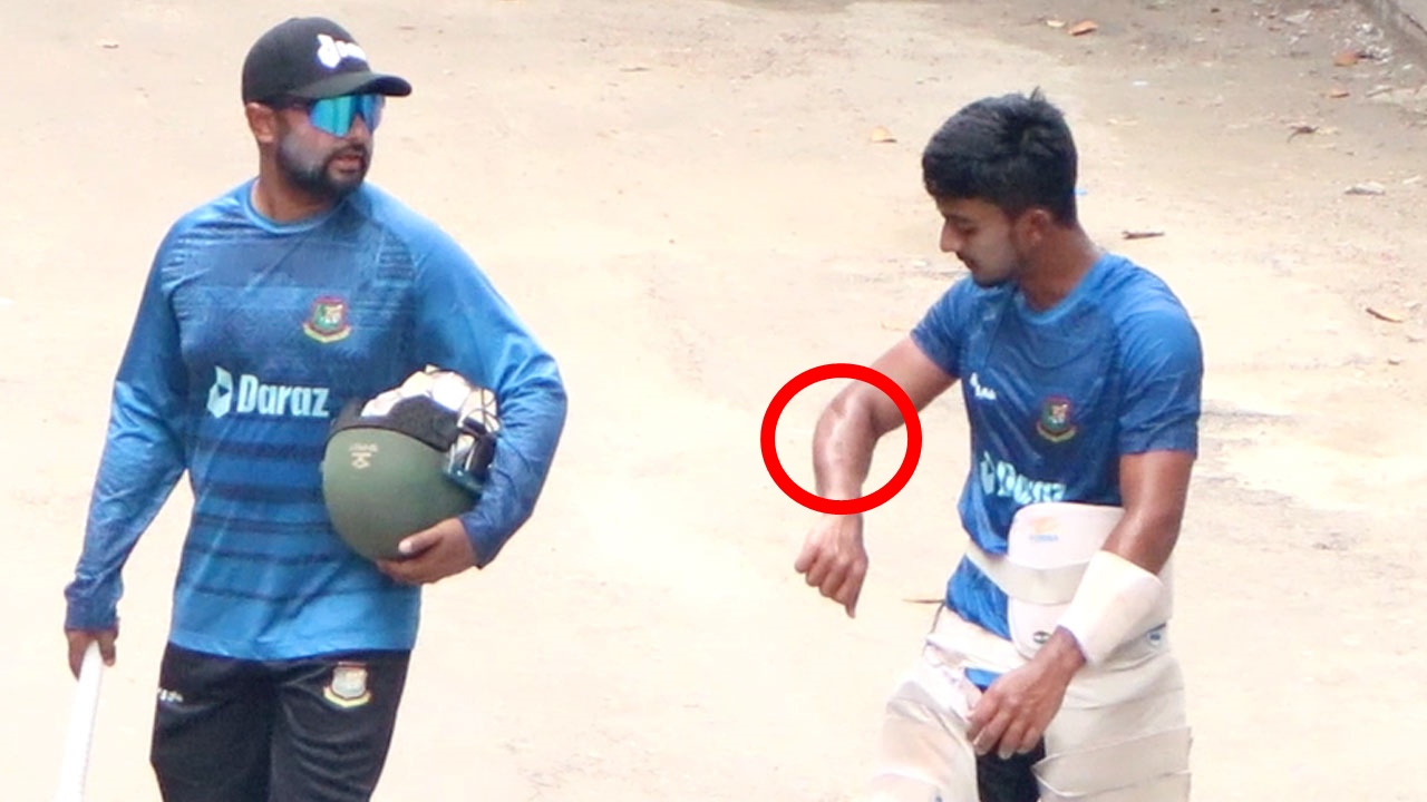 প্র্যাক্টিস করতে গিয়ে হঠাৎ হাতের ইনজুরিতে শাহাদাত হোসাইন দিপু।